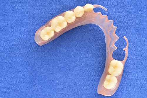 Dentures - Campus Dentist