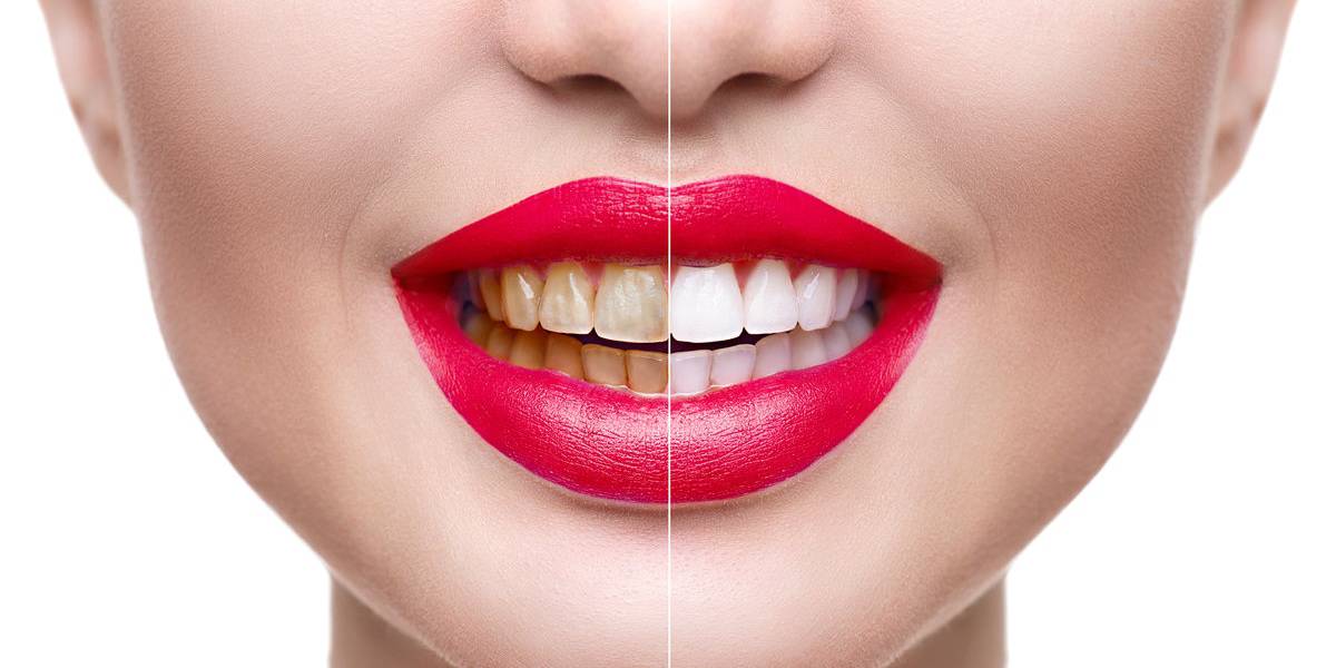 cosmetic dentistry - Campus dentist