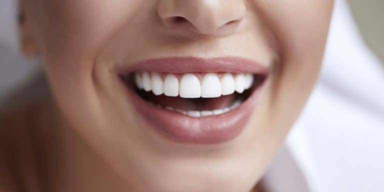 smile enhancement - Campus dentist